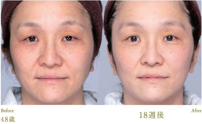 Lucia|Esthetic Skin Lotion 120ml