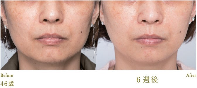 Lucia|Esthetic Skin Lotion 120ml