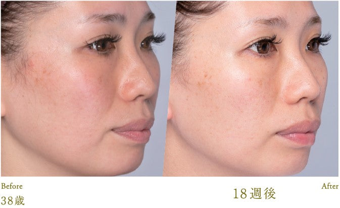 Lucia｜Esthetic Skin Cream 30g