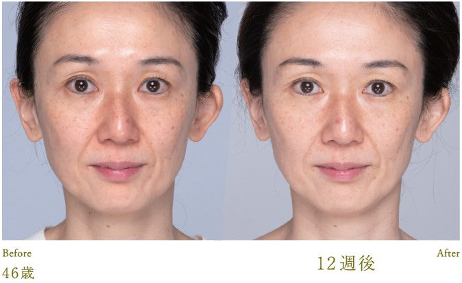 Lucia｜Esthetic Skin Facial Mask (5 sheets)