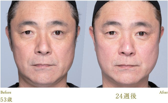 Lucia｜Esthetic Skin Cream 30g