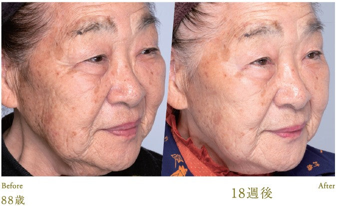 Lucia｜Esthetic Skin Cream 30g