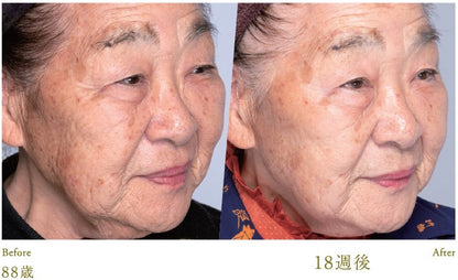 Lucia｜Esthetic Skin Cream 30g